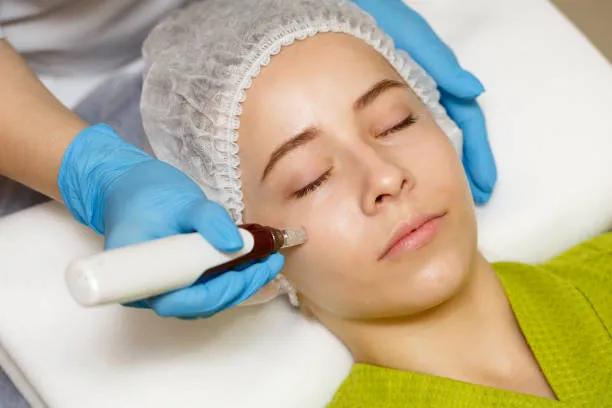 Does Microneedling Help with Sun-Damaged Skin? cover picture