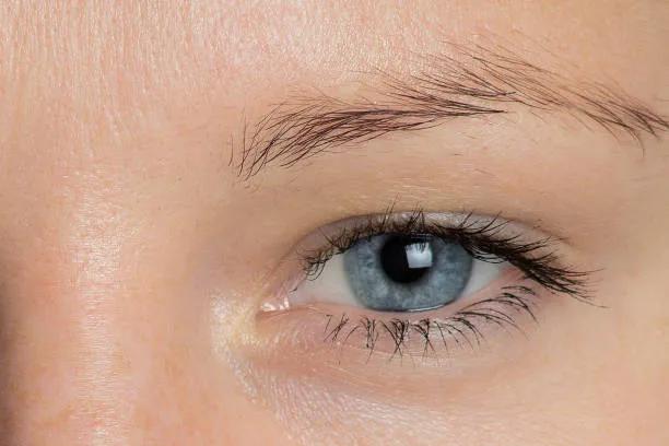 Can Eyelid Surgery Fix Tired-Looking Eyes? cover picture
