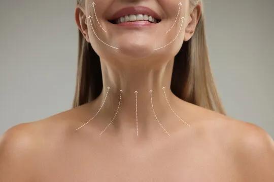 Is Neck Lift Surgery a Good Anti-Aging Choice? cover picture