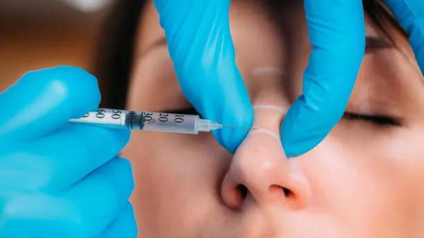 Can Botox for Nose Improve Profile Without Surgery? cover picture