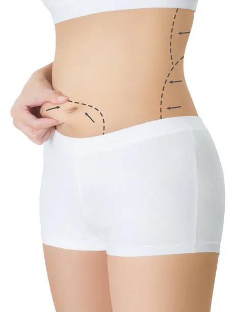 Is Liposuction Effective for Lower Belly Pouch? cover picture