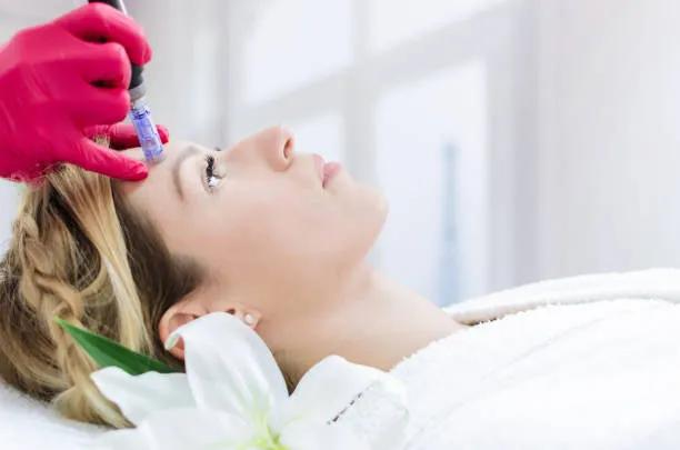 Does Microneedling Improve Rough Skin Texture? cover picture