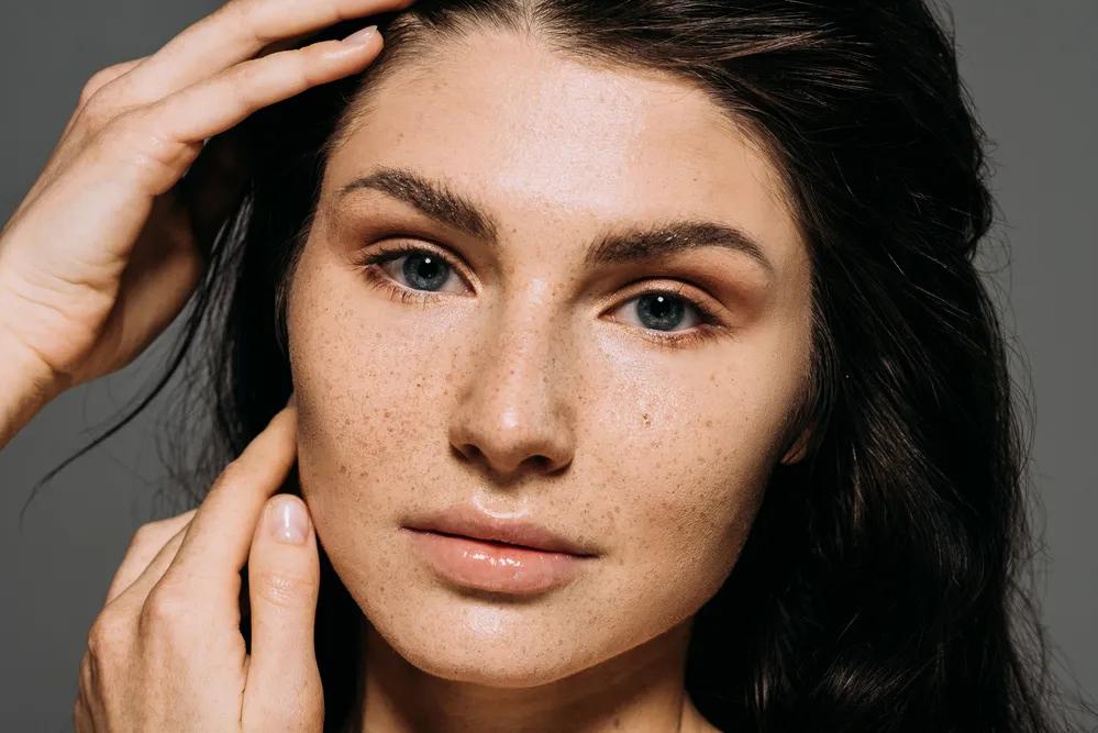 How Does Melasma Treatment Improve Clear Skin? cover picture