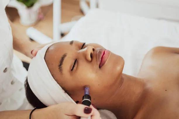 Does RF Microneedling Work for Enlarged Pores? cover picture