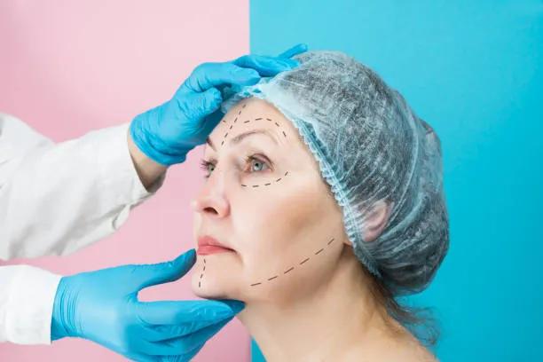 Can Facelifts Deliver Natural Looking Results? cover picture