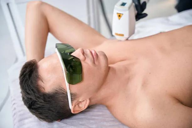 Can laser hair removal for men treat coarse hair? cover picture