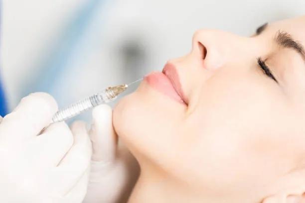 Does lip filler Help Restore Youthful Lip Shape? cover picture