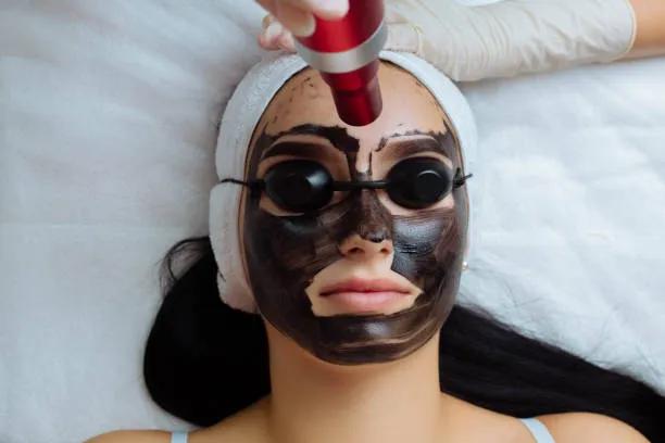 Does Laser Carbon Peel Help Prevent Future Breakouts? cover picture