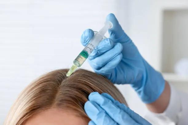 Can the Best PRP Hair Treatment Improve Hairline? cover picture