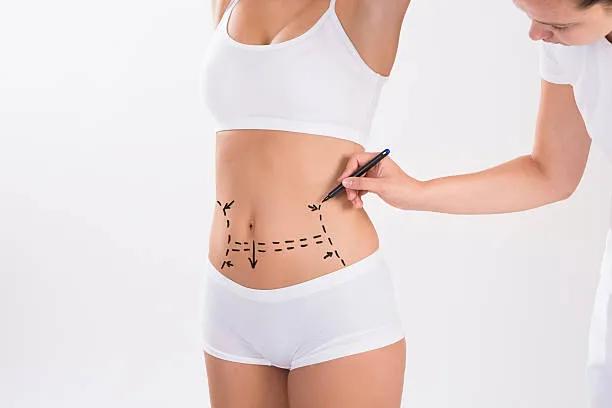 Can Mini Tummy Tuck Target Stubborn Belly Skin? cover picture