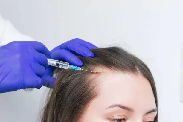 Does PRP Treatment Help with Hair Thinning? cover picture