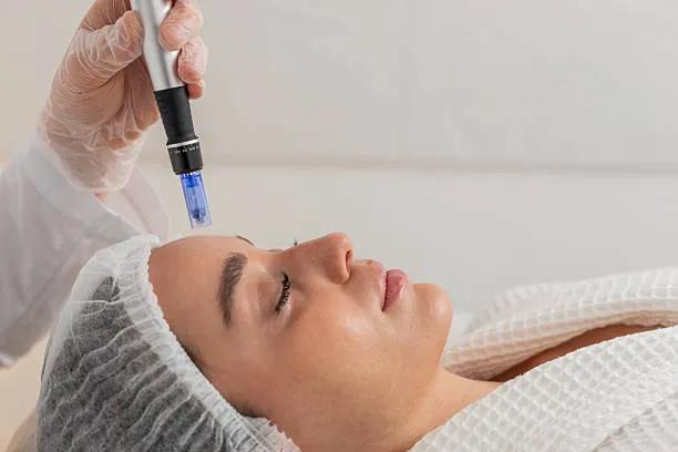 Can Microneedling Restore a Youthful Glow? cover picture