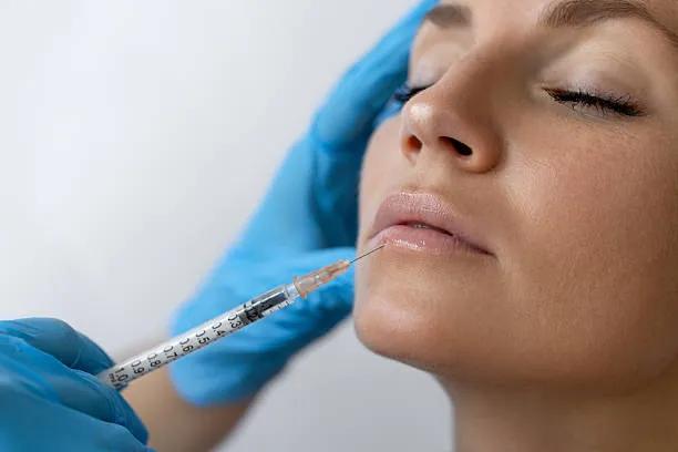 Can Lip Fillers Injection Help Aging Lips? cover picture