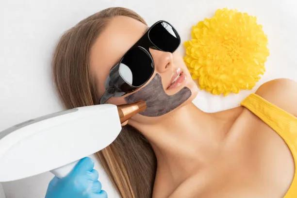 Does Laser Carbon Peeling Help with Pigmentation? cover picture