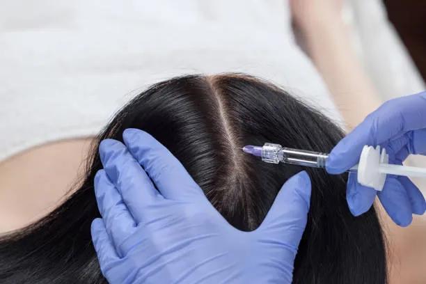 Does PRP Hair Treatment Work for All Hair Types? cover picture