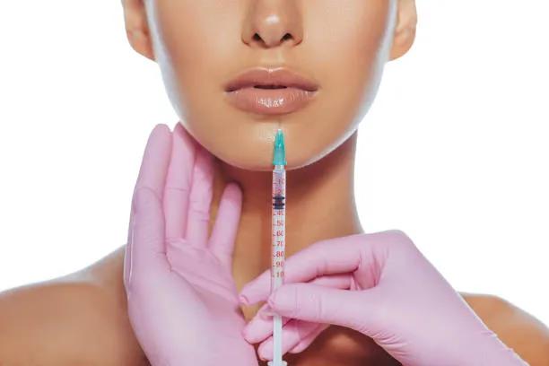 Can Russian Lip Fillers Improve Lip Contours? cover picture