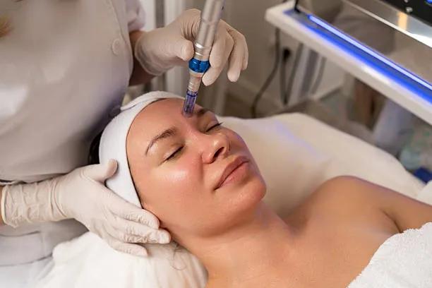 Can Dermapen Treatment Restore Youthful Skin? cover picture
