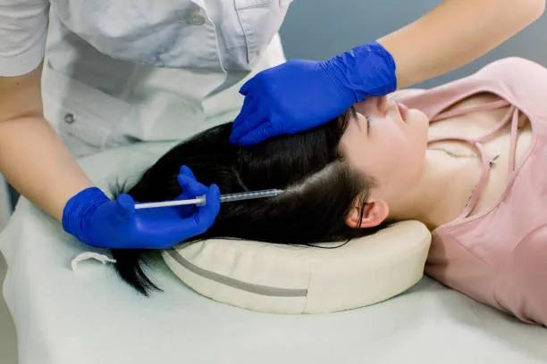 Does PRP Hair Treatment Help with Alopecia? cover picture