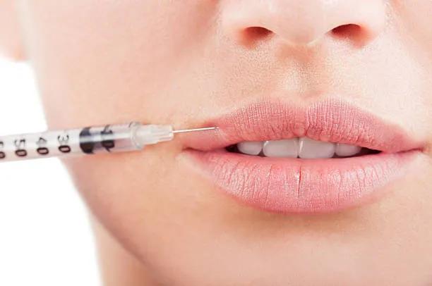 Is Lip Fillers Injection Good for Small Lips? cover picture