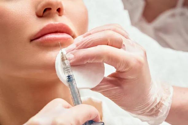 Can Lip Fillers Injection Restore Natural Lip Definition? cover picture