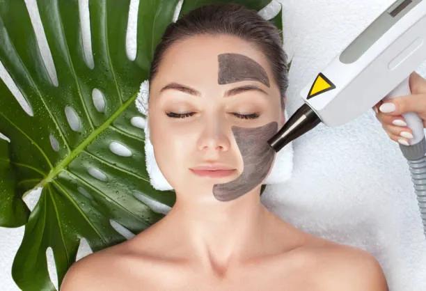 Can Laser Carbon Peel Improve the Look of Acne Scars? cover picture