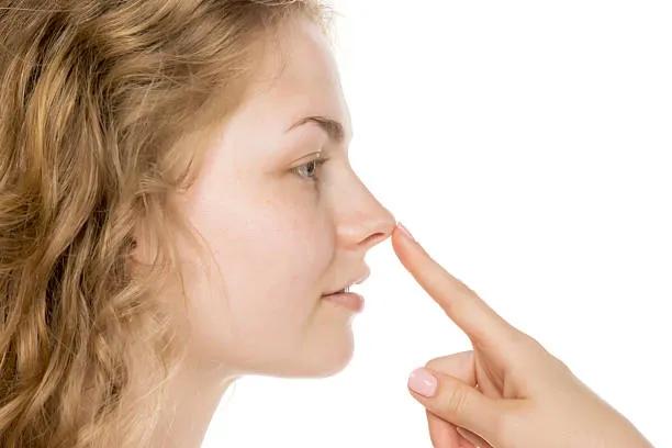Can Liquid Rhinoplasty Make a Nose Bump Less Noticeable? cover picture