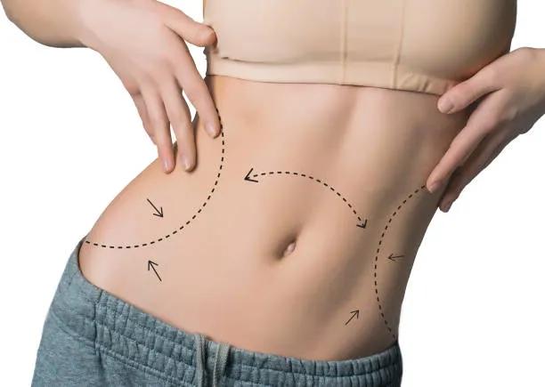 What Should You Expect From a Liposuction Procedure? cover picture