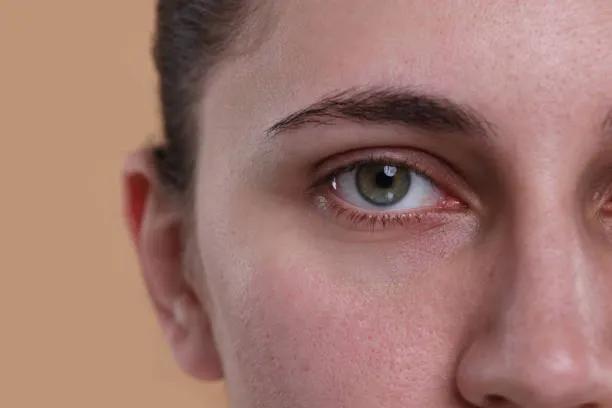 Can Eyelid Surgery Refine the Upper Eye Area ? cover picture