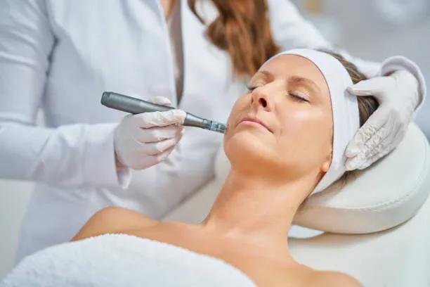Can Fractional RF Micro Needling Refine Skin Texture? cover picture