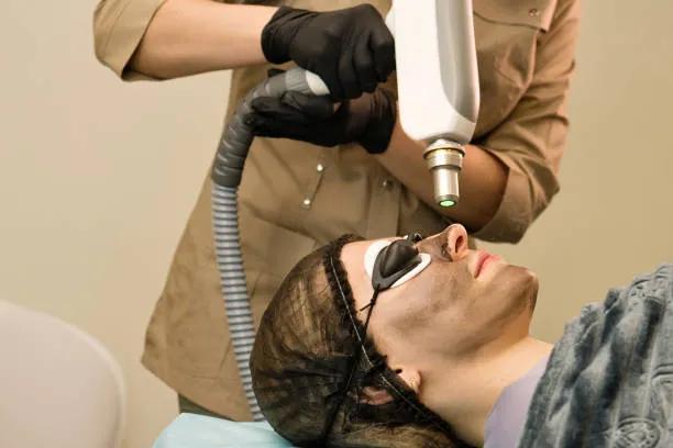 Can Laser Carbon Peel Help Revive Dull Skin? cover picture