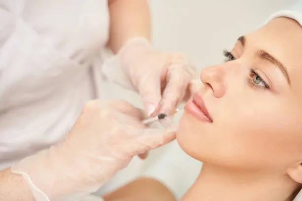 Do Lip Filler Injections Enhance Cupid’s Bow? cover picture