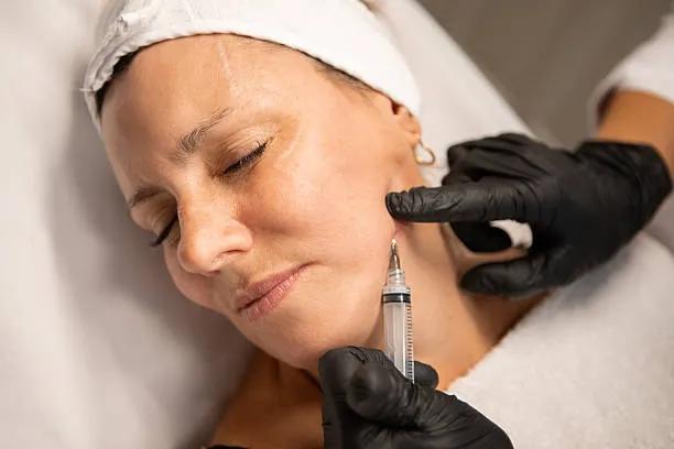 Can Exosome Therapy Complement Microneedling? cover picture