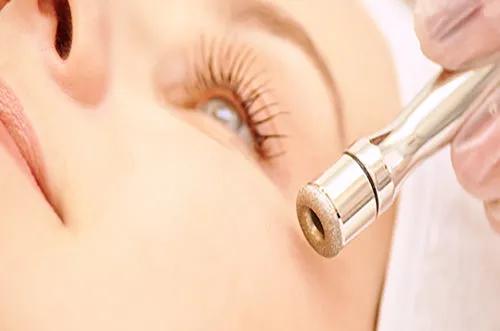 Who Is a Good Candidate for Diamond Peel? cover picture