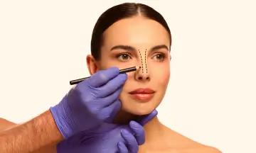 Plastic Surgery Treatment in Bangalore: cover picture