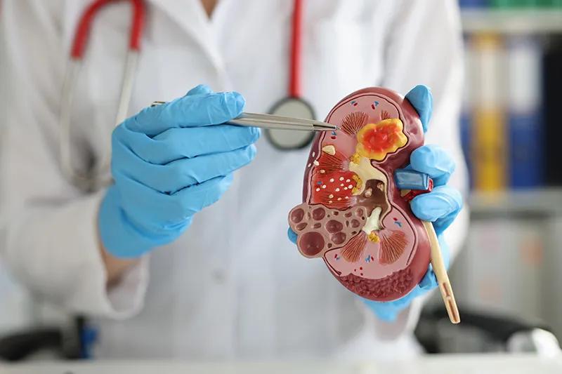 Nephrologist in Bangalore: Expert Kidney cover picture