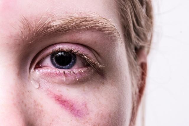 Activities To Improve Your Mental Health After A Traumatic Event cover picture