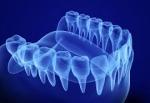 Risks of Denture Repair at Home cover picture
