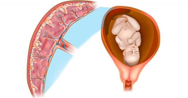 Placental Insufficiency cover picture