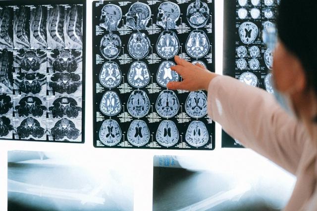 Understanding the Long-Term Impact of Traumatic Brain Injuries and the Role of an Injury Lawyer cover picture