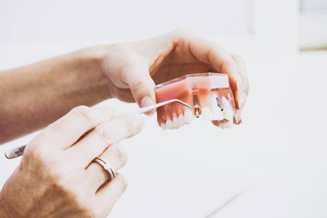 Full Arch Restoration: Is All-on-4 Dental Implants Right for You? cover picture
