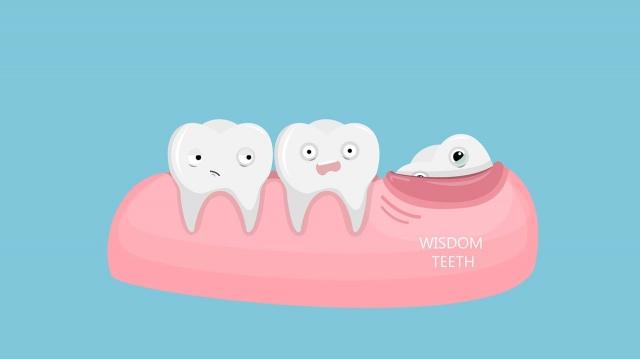 Wisdom Teeth Extraction: A Guide to Oral Health cover picture