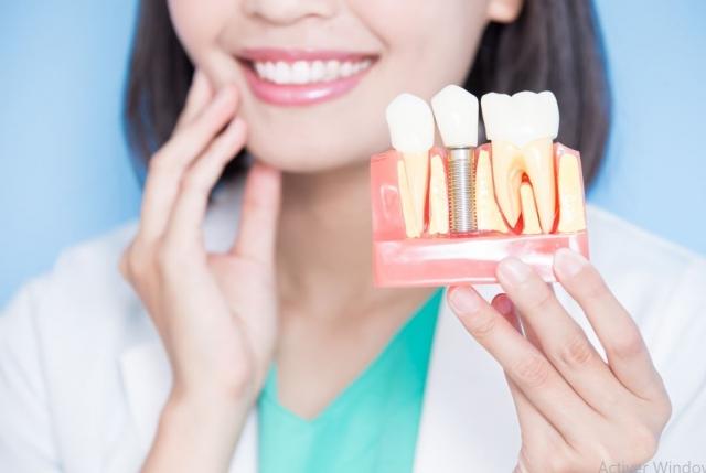 Key Considerations When Choosing an Implant Dentistry Course cover picture