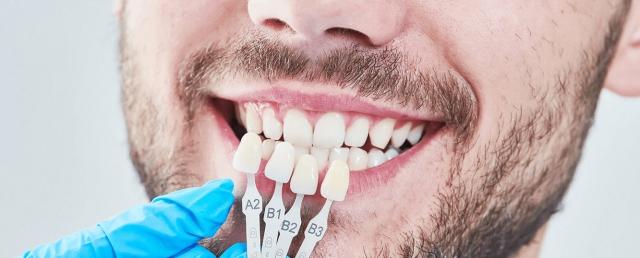 Cost of Porcelain Veneers: What You Need to Know cover picture
