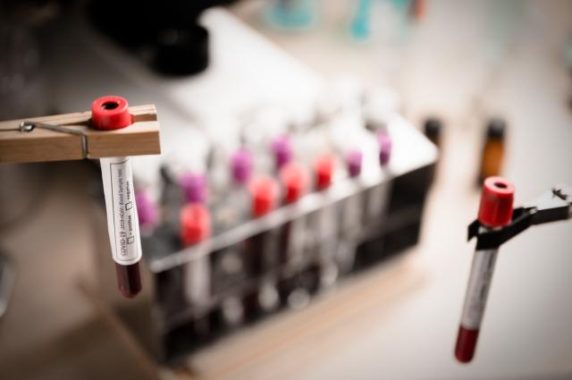 Understanding Full Panel Blood Tests: What They Measure and Why They Matter cover picture
