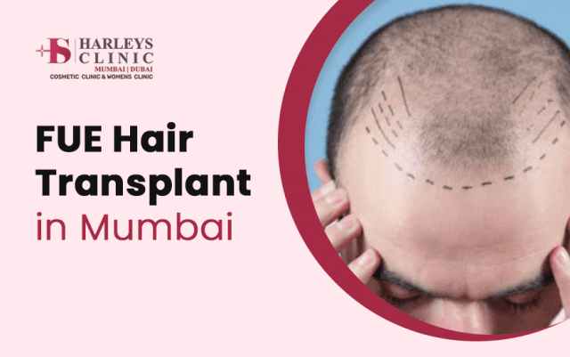 What Benefits Does FUE Hair Transplant Provide? cover picture
