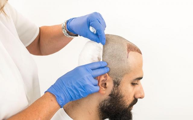 Nurturing Your New Growth: Essential Tips for Hair Care After a Hair Transplant cover picture