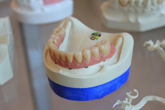 SLA vs. RBM Surfaces: How Implant Surface Technology Shapes Healing cover picture