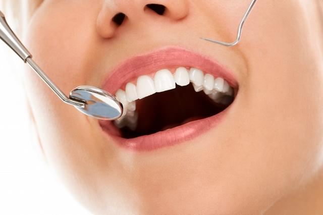 The Top 5 Most Common Causes of Tooth Loss cover picture