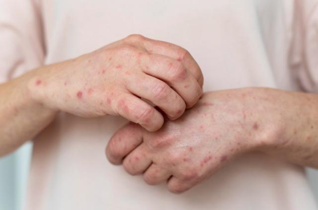 Buy Metronidazole Online: Your Complete Guide to Safe and Effective Infection Treatment cover picture