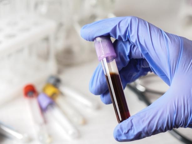 A Guide To At-Home Blood Tests cover picture